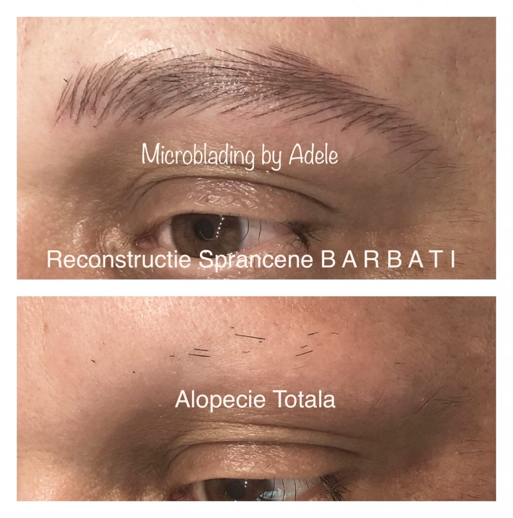 microblading, micropigmentare, by Adele, sprancene fir cu fir, alopecia, alopecie, sprancene barbat, sprancene barbati, sprancene pret, rezultate naturale, salon machiaj, machiaj semipermanent, dermopigmentare, tehnica powder, bucuresti, ploiesti, sprancene vedete, micropigmentare vedete