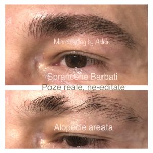 2024_07_28_17_08_IMG_7810 microblading, micropigmentare, by Adele, sprancene fir cu fir, alopecia, alopecie, sprancene barbat, sprancene barbati, sprancene pret, rezultate naturale, salon machiaj, machiaj semipermanent, dermopigmentare, tehnica powder, bucuresti, ploiesti, sprancene vedete, micropigmentare vedete