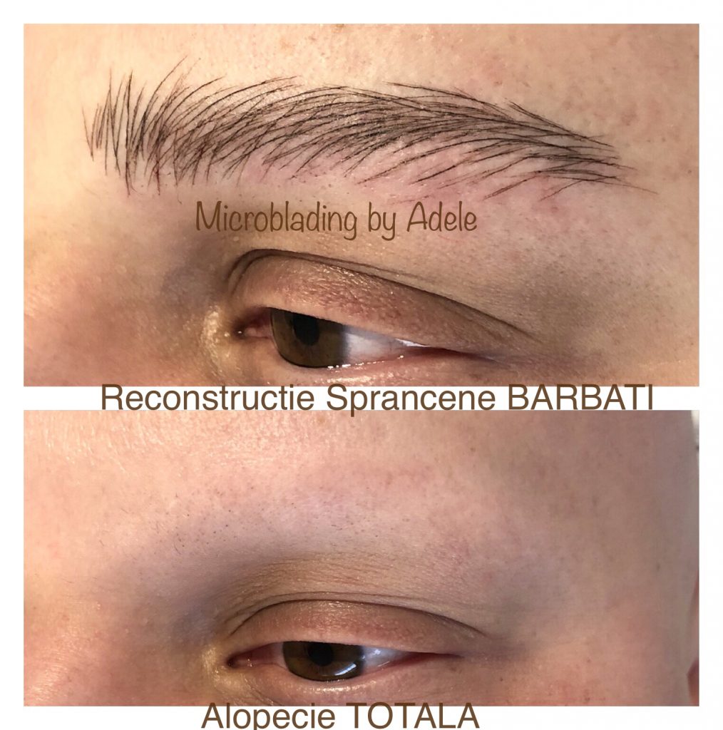 microblading, micropigmentare, by Adele, sprancene fir cu fir, alopecia, alopecie, sprancene barbat, sprancene barbati, sprancene pret, rezultate naturale, salon machiaj, machiaj semipermanent, dermopigmentare, tehnica powder, bucuresti, ploiesti, sprancene vedete, micropigmentare vedete
